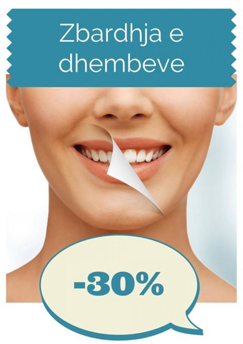 Zbardhja e dhëmbëve